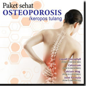 Paket Sehat Osteoporosis Keropos Tulang
